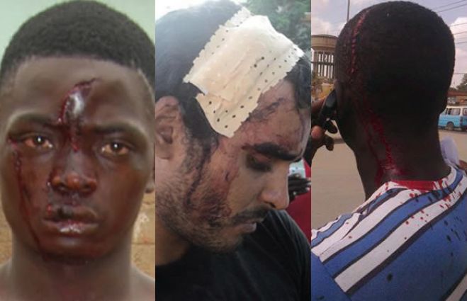 Aumentam denúncias de violência policial em Angola