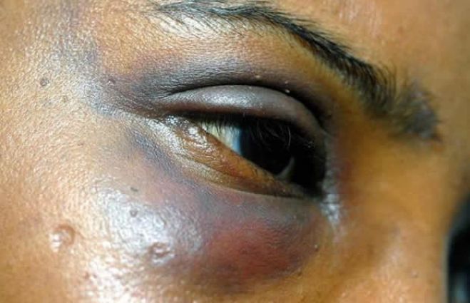 80% das mulheres angolanas são vítimas de violência doméstica - OCDE
