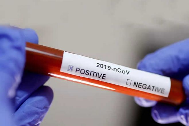 Sobe para 112 o número de infetados com coronavírus em Portugal e Brasil tem agora 85 casos
