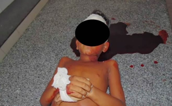 Criança de seis anos espancada até a morte pelo próprio pai no Huambo