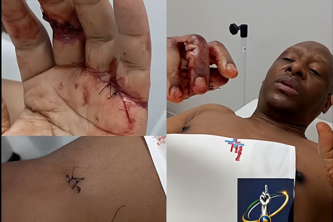 Norberto Garcia esfaqueado durante assalto no Boavida