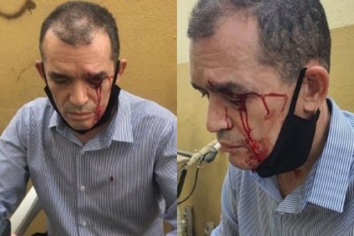 O pastor Israel Gonçalves foi agredido