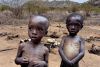 Malnutrição provocou este ano 364 mortes de crianças angolanas na Huíla