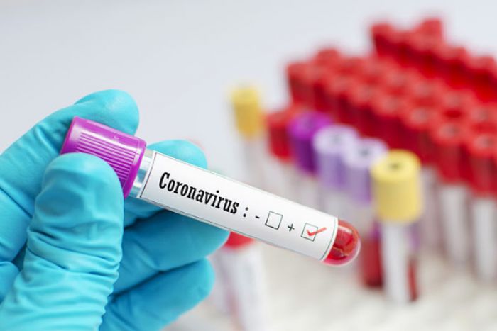 Ministério da Saúde de Angola confirma dois casos positivos de coronavírus