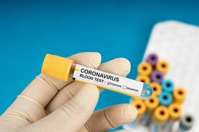 Resultados de cinco casos suspeitos de coronavírus deram negativos