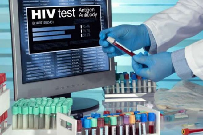 Ministério da Saúde de Angola veta reagente de testes de HIV
