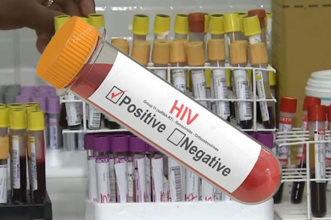 PGR averiguá falhas do reagente de teste de HIV