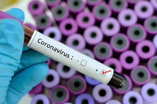 O Site Worldeters indica que Angola e Cabo Verde tem os primeiros caso de Coronavírus