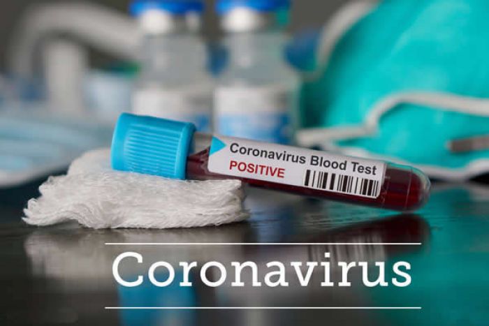 Coronavírus: Angola com sete novos casos suspeitos